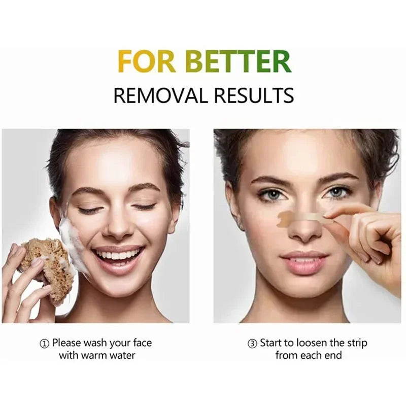 Breathing Nasal Strips